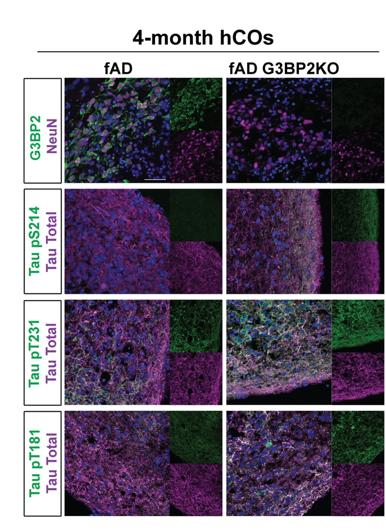 Open access visualization of Microscopy, Immunohistochemical Staining, hCOs, G3BP2, NeuN