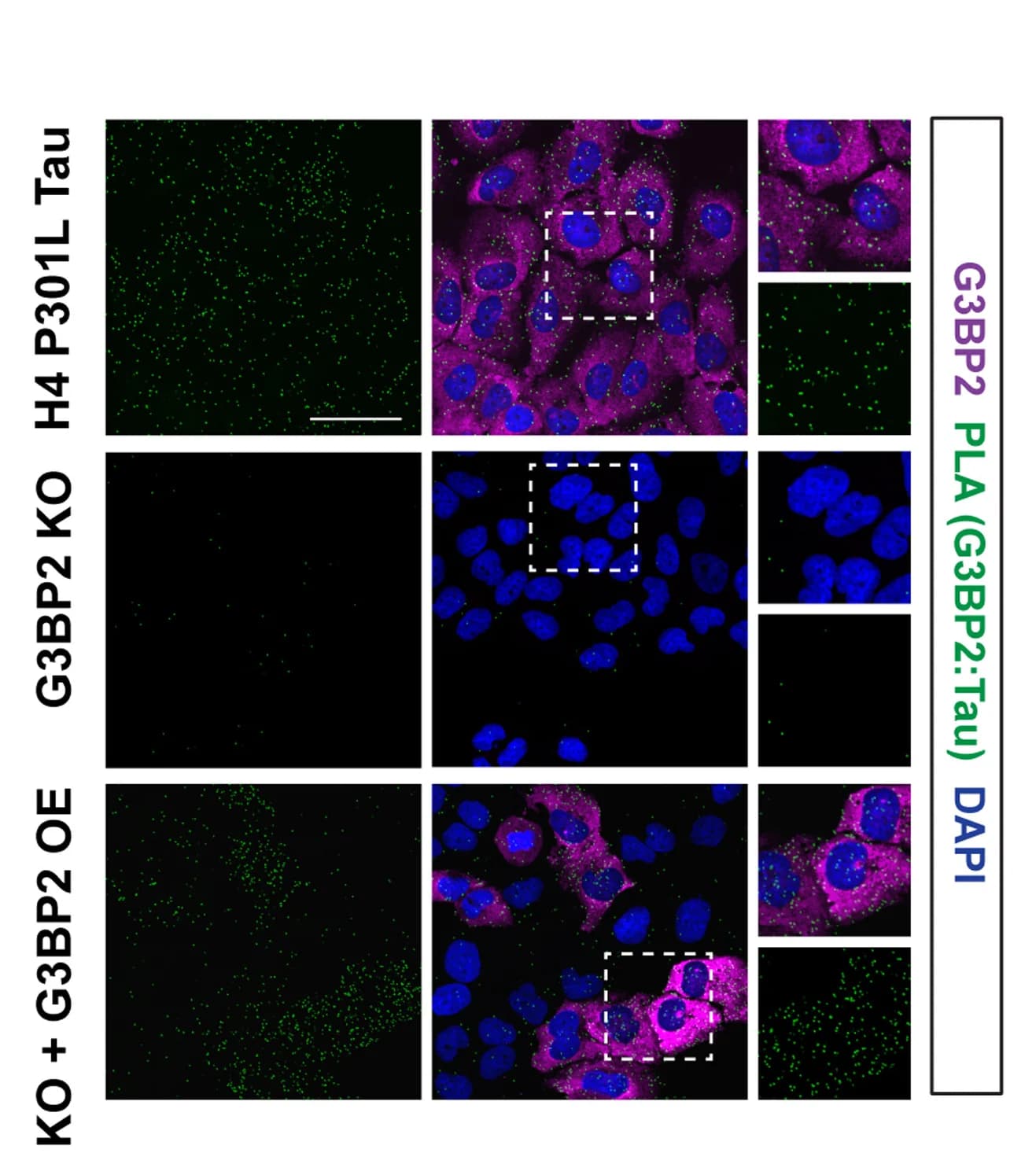Open access visualization of Microscopy, PLA Signal, Tau, G3BP2, Cell Imaging