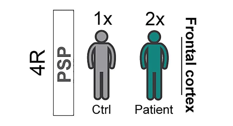 Open access visualization of Illustration, PLA, Tau, FTLD-Tau, PSP