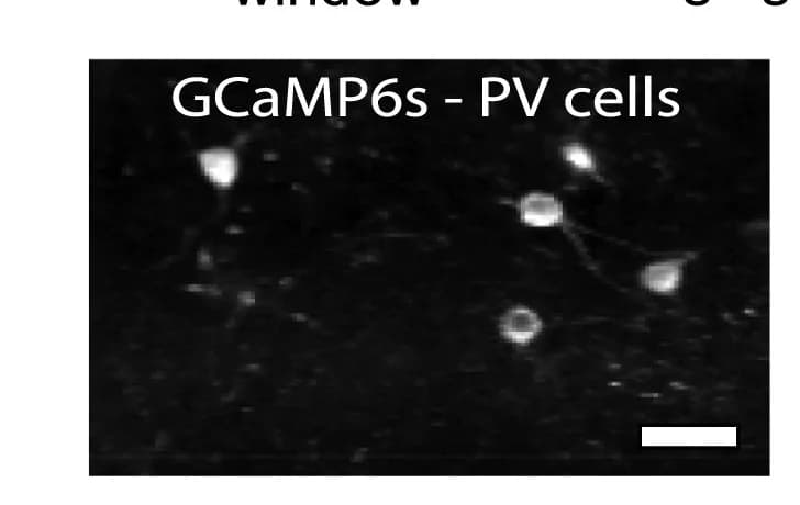 Open access visualization of Microscopy, PV-INs, AAV1-flex-GCaMP6s, S1 Cortex, PV-Cre Mice