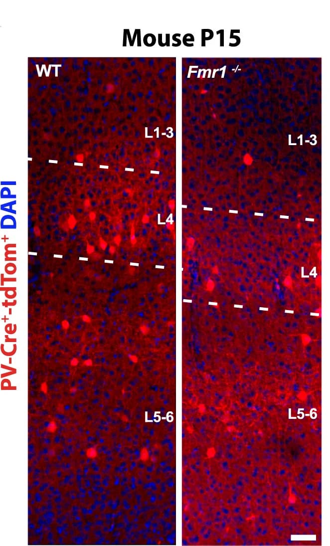Open access visualization of Microscopy, Coronal Sections, Barrel Field, S1 Cortex, PV-Cre;tdTom Mice