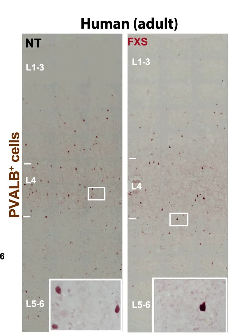 Open access visualization of Microscopy, Coronal Sections, BA3, Neurotypical Human Tissue, FXS Human Tissue