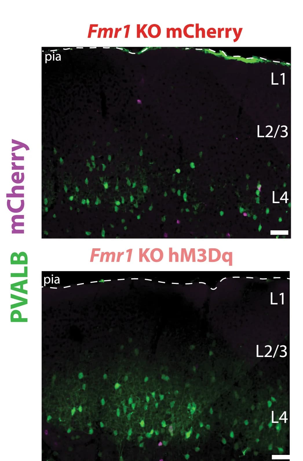 Open access visualization of Microscopy, PVALB immunostaining, Images