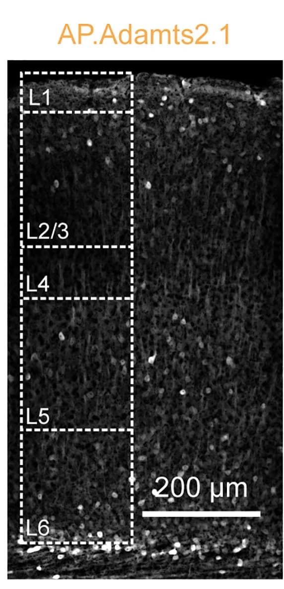 Open access visualization of Microscopy, Expression Pattern, AAV2/1-AP.Adamts2.1-eGFP, V1