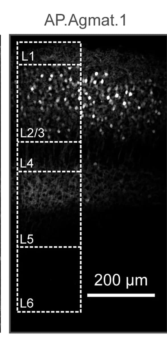 Open access visualization of Microscopy, Expression Pattern, AAV2/1-AP.Agmat.1-eGFP, V1