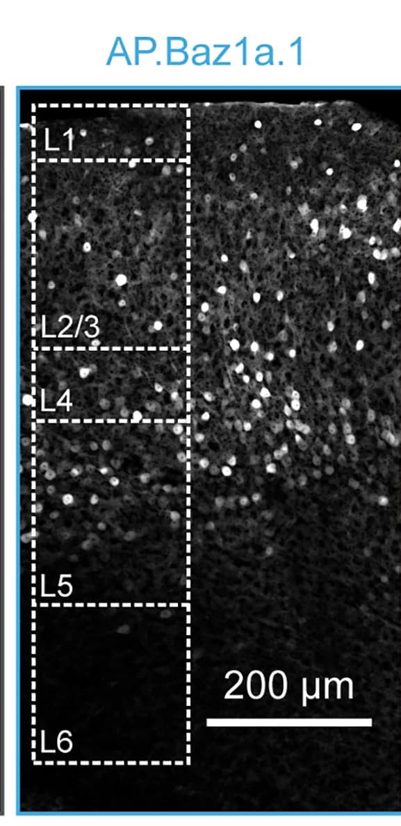 Open access visualization of Microscopy, Expression Pattern, AAV2/1-AP.Baz1a.1-eGFP, V1
