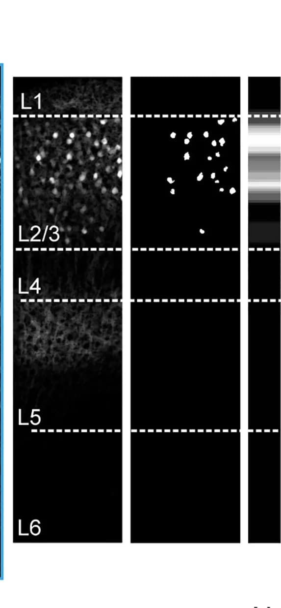 Open access visualization of Microscopy, Histology Images, Expression Profiles, Cortical Depth