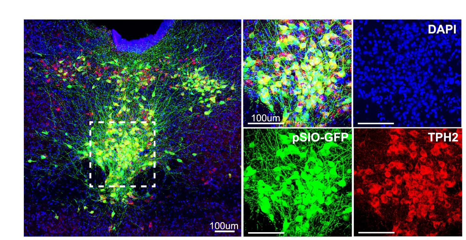 Open access visualization of Microscopy, EGFP Expression, Tryptophan Hydroxylase-Positive Neurons, Fluorescent Image