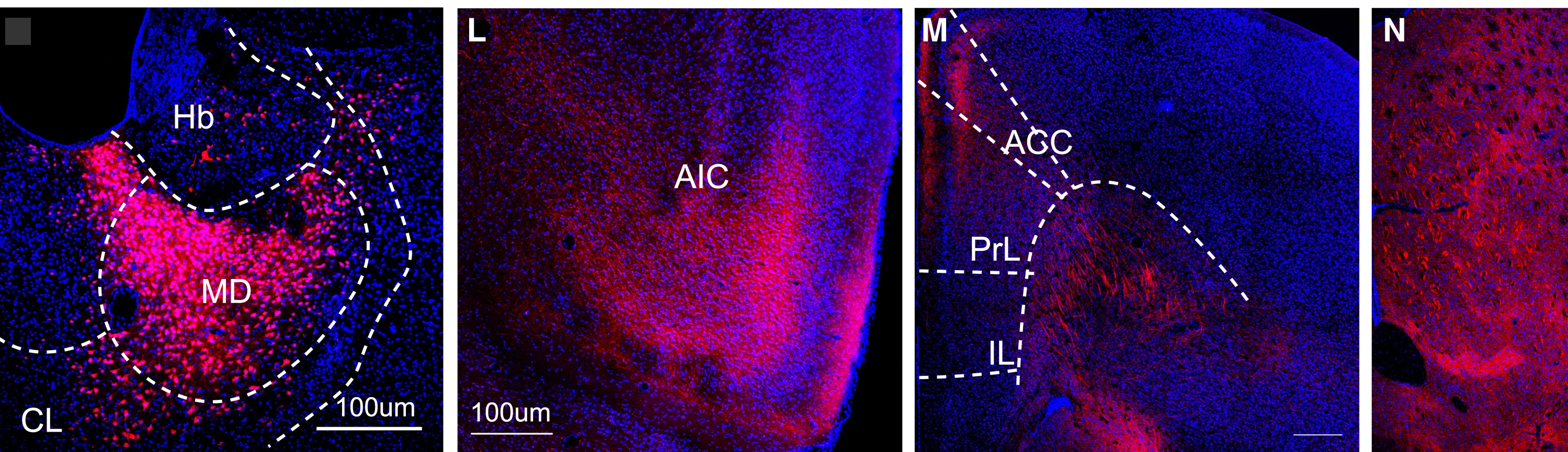 Open access visualization of Microscopy, AAV-EF1α-pSIO-mScarlet-I, Mediodorsal Thalamus, VGLUT2-P2A-ΦC31 Mice, Injection Site