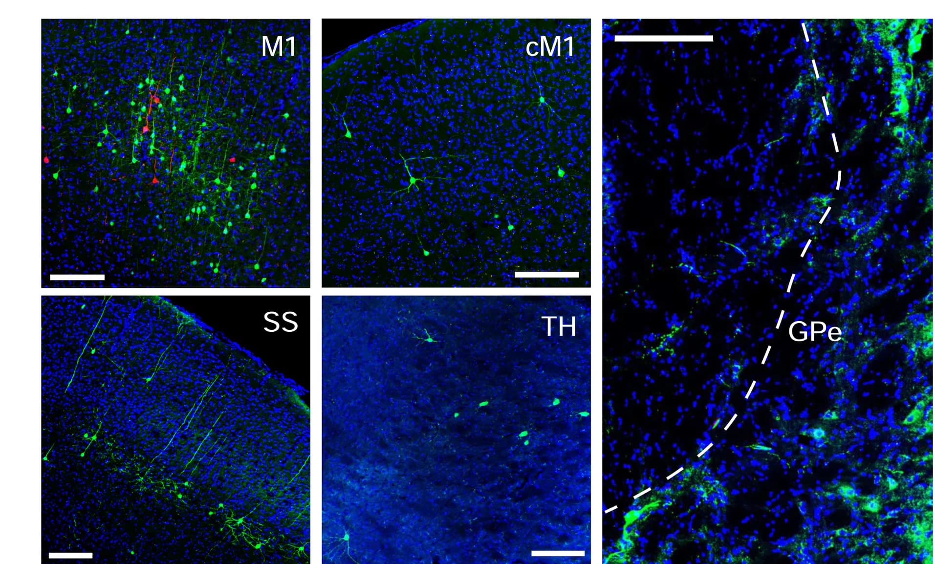 Open access visualization of Microscopy, Injection Sites, M1, Brain Areas, Starter Cells
