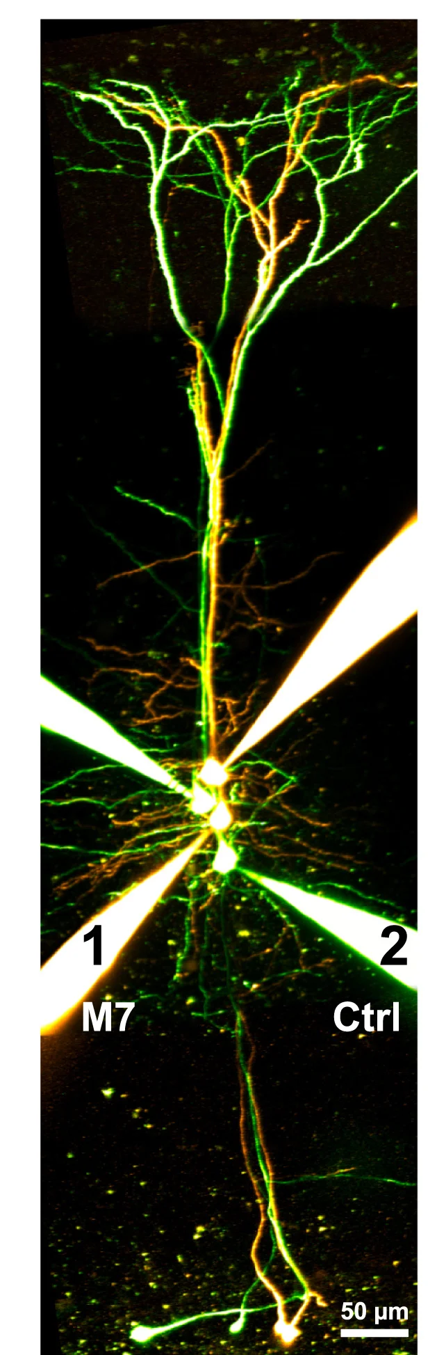 Open access visualization of Microscopy, Monosynaptic Excitation, Disynaptic Inhibition, Inhibitory Postsynaptic Potentials, Translation Blockade