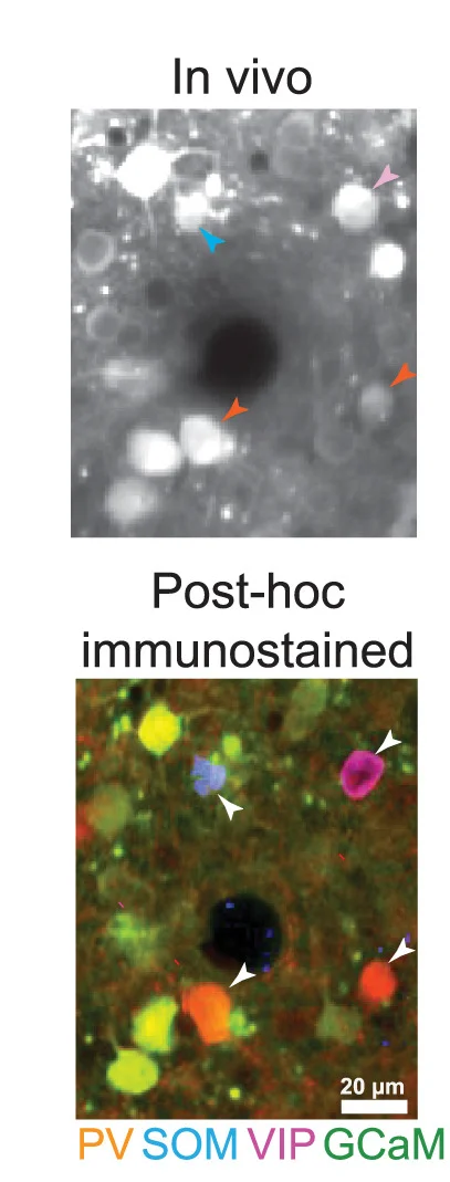 Open access visualization of Microscopy, In Vivo Imaging, Neurons, Immunostaining, Interneurons