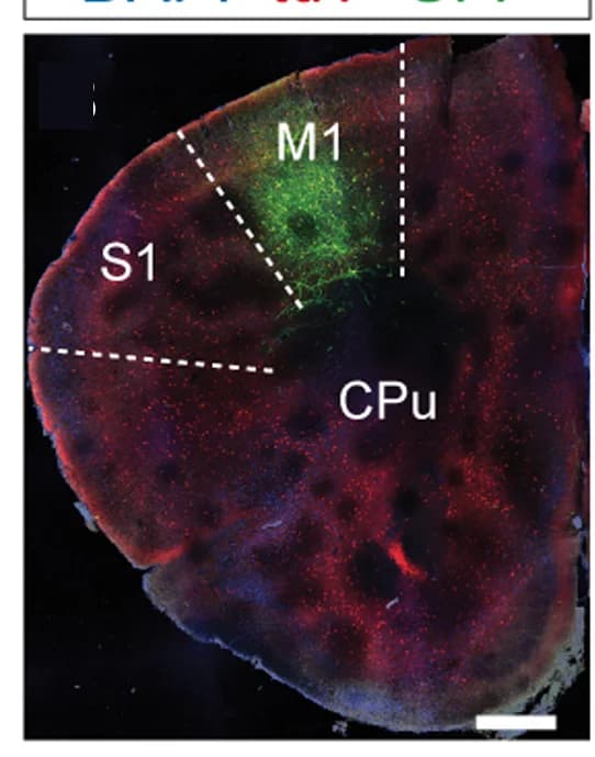 Open access visualization of Microscopy, Coronal Section, Injection Site, tdTomato, GFP