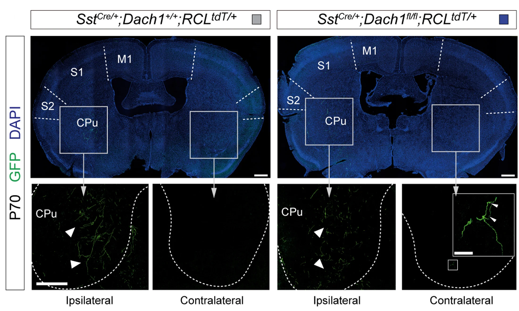 Open access visualization of Microscopy, Coronal Sections, Mouse Telencephalon, GFP, Control