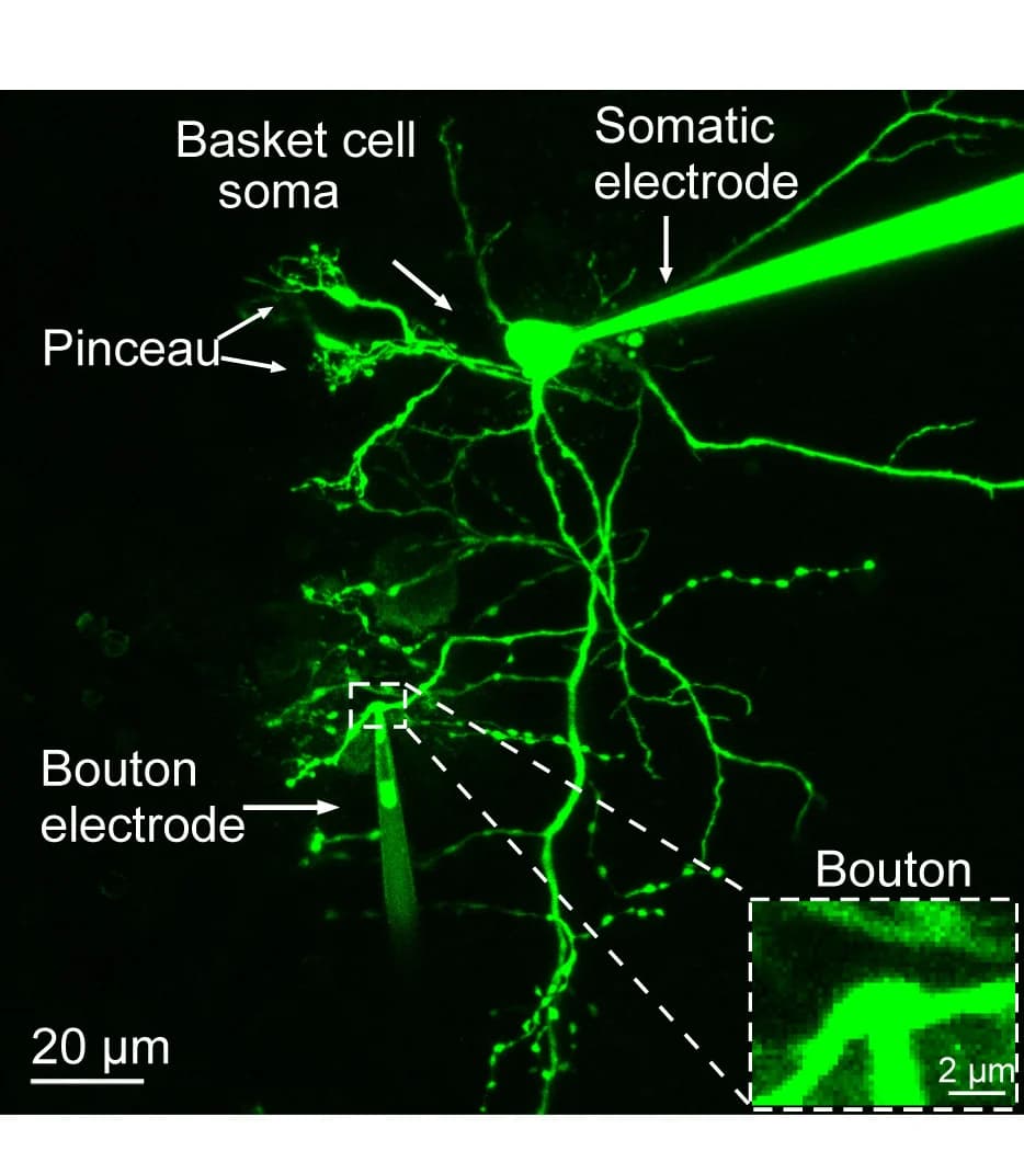Open access visualization of Microscopy, Confocal Microscopy, BC, Alexa Fluor 488, Somatic Patch Pipette