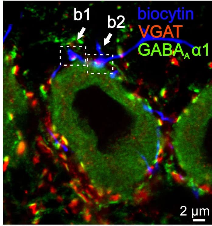 Open access visualization of Microscopy, Confocal Microscopy, Fluorescence Micrographs, Biocytin, VGAT