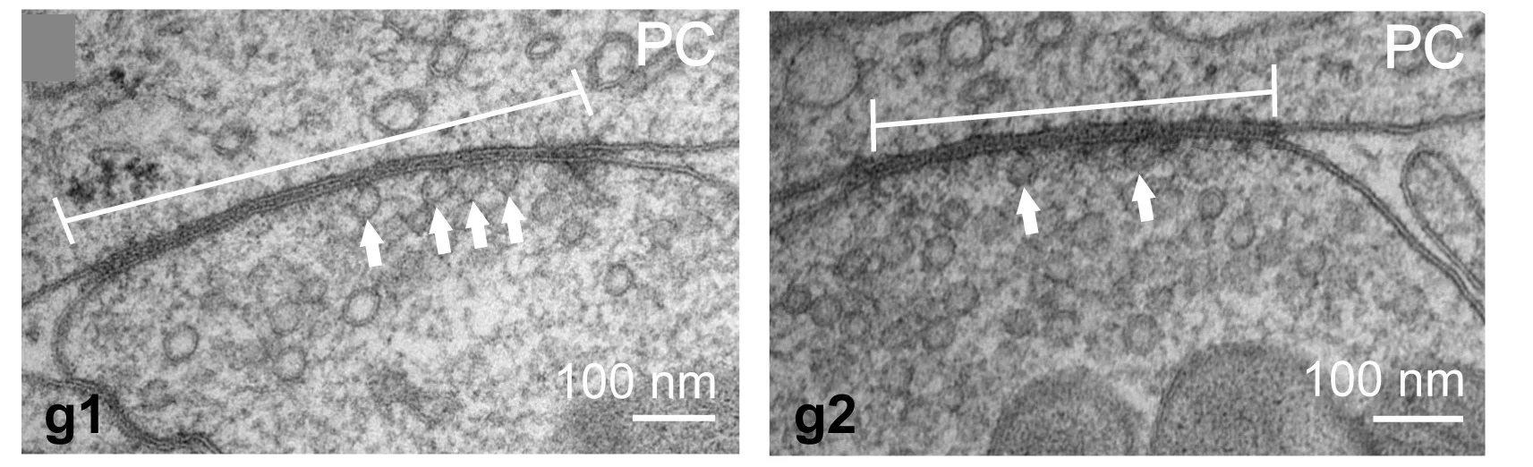 Open access visualization of Microscopy, Transmission Electron Micrographs, Docked Vesicle Distribution, Serial Sections, Active Zone