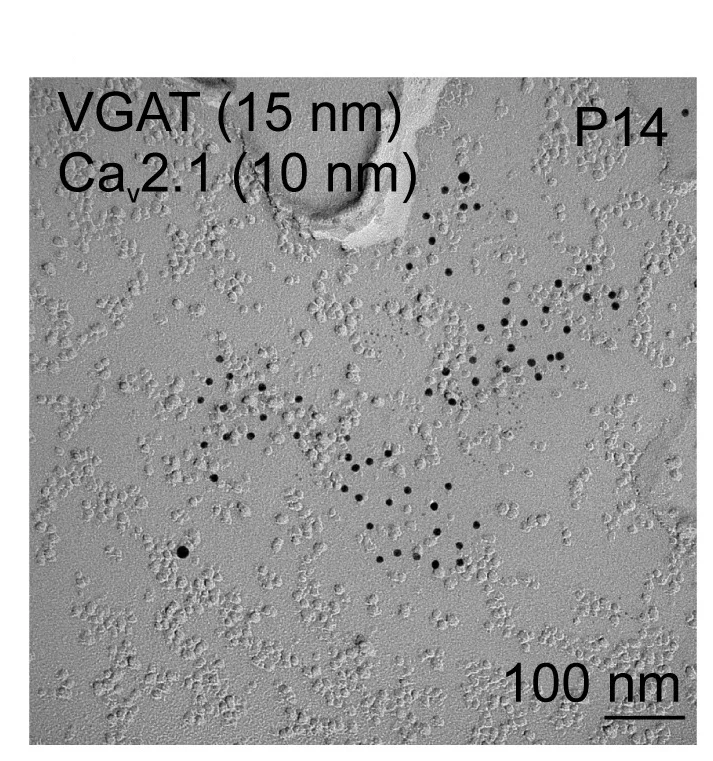Open access visualization of Microscopy, Cav2.1 Clusters, Active Zones, Electron Microscopy, P14-16 Age Group