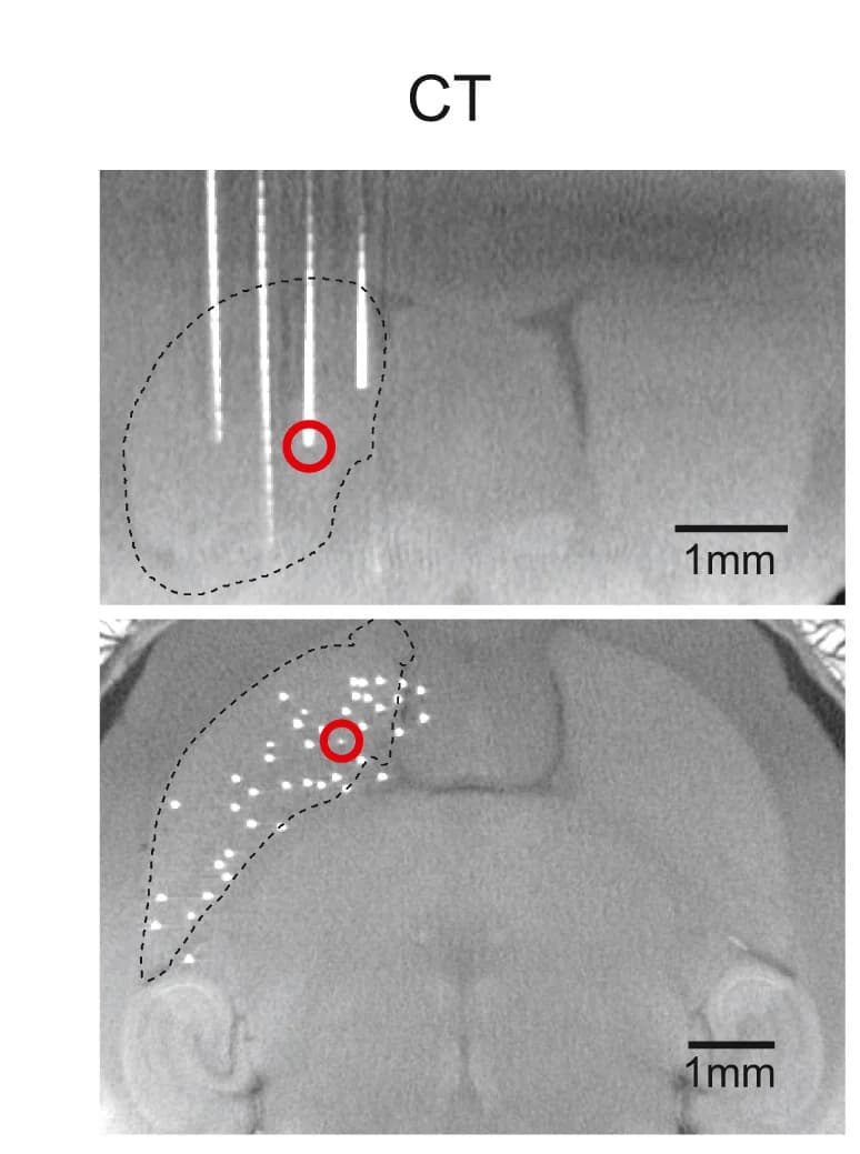 Open access visualization of Microscopy, Fiber Tip, Localization, Micro-CT Scan, Optical Fibers