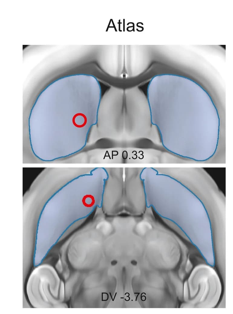 Open access visualization of Microscopy, Atlas Images, Coronal Plane, Horizontal Plane, CT Images