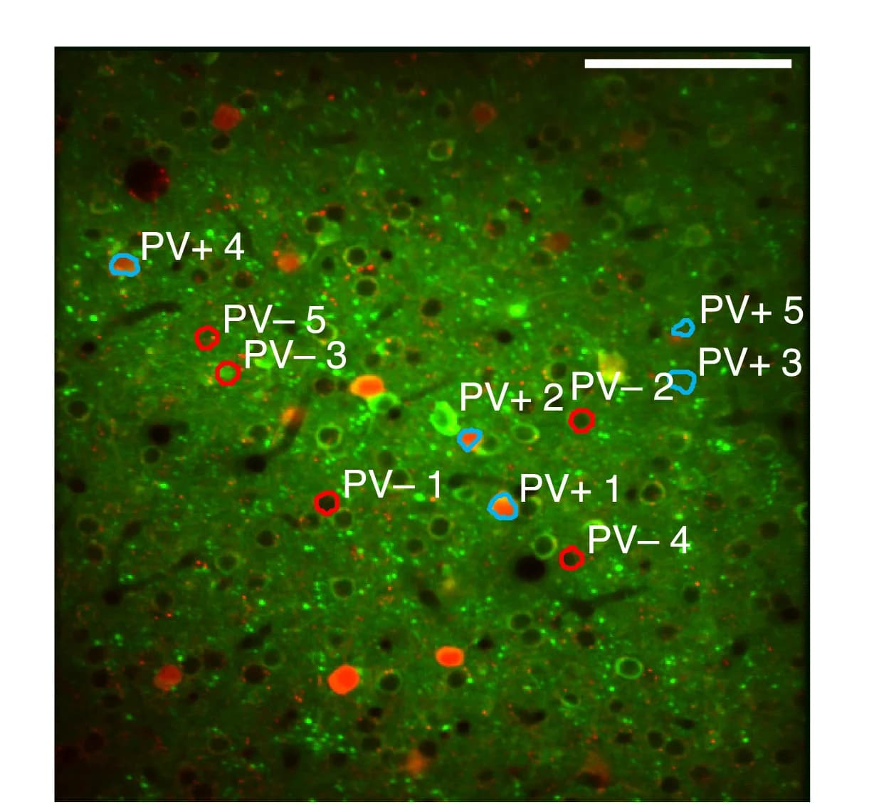 Open access visualization of Microscopy, Fluorescence Image, Spatial Location, Neurons