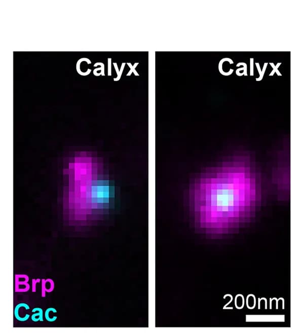 Open access visualization of Microscopy, Brp, Cacophony, ExLLSM, Synapse