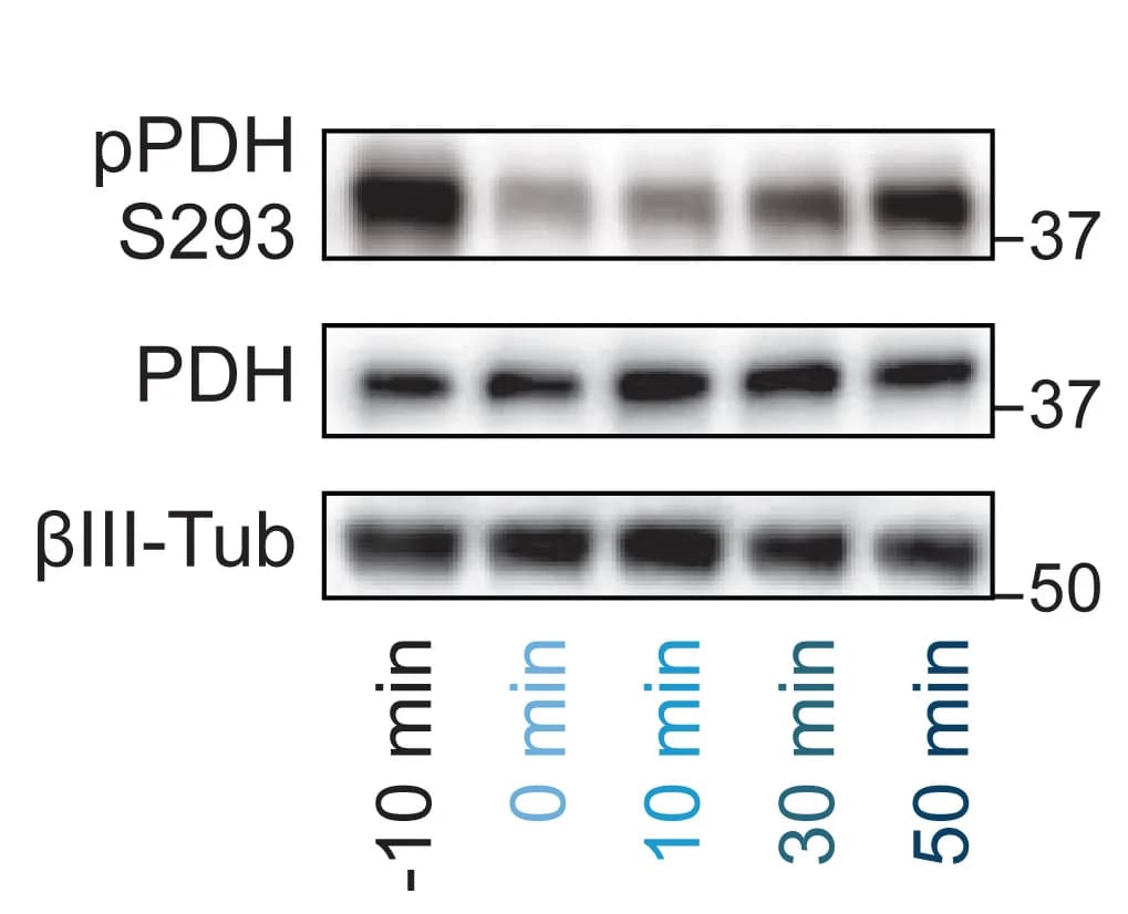 Open access visualization of Gel, Whole-Cell Lysis, Immunoblot Analysis