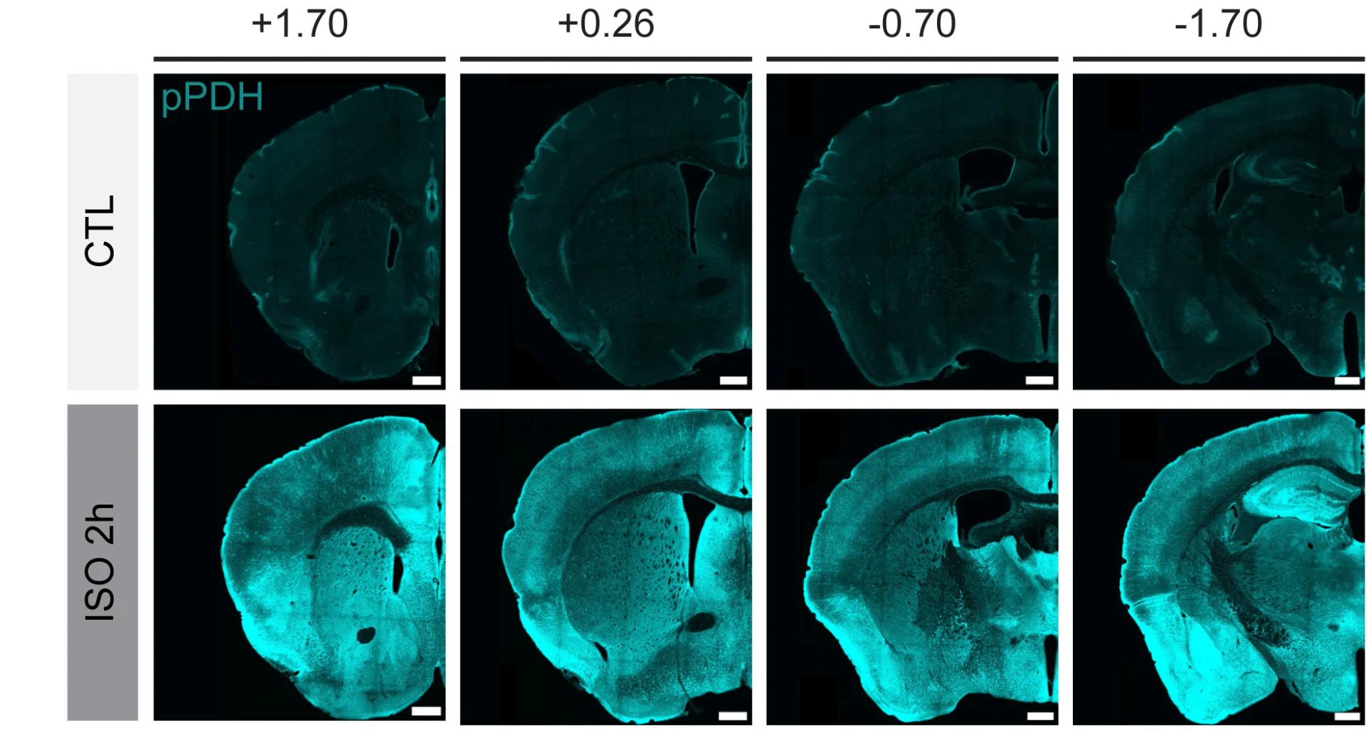 Open access visualization of Microscopy, pPDH Labeling, Brain, General Anesthesia, Brain Coronal Sections