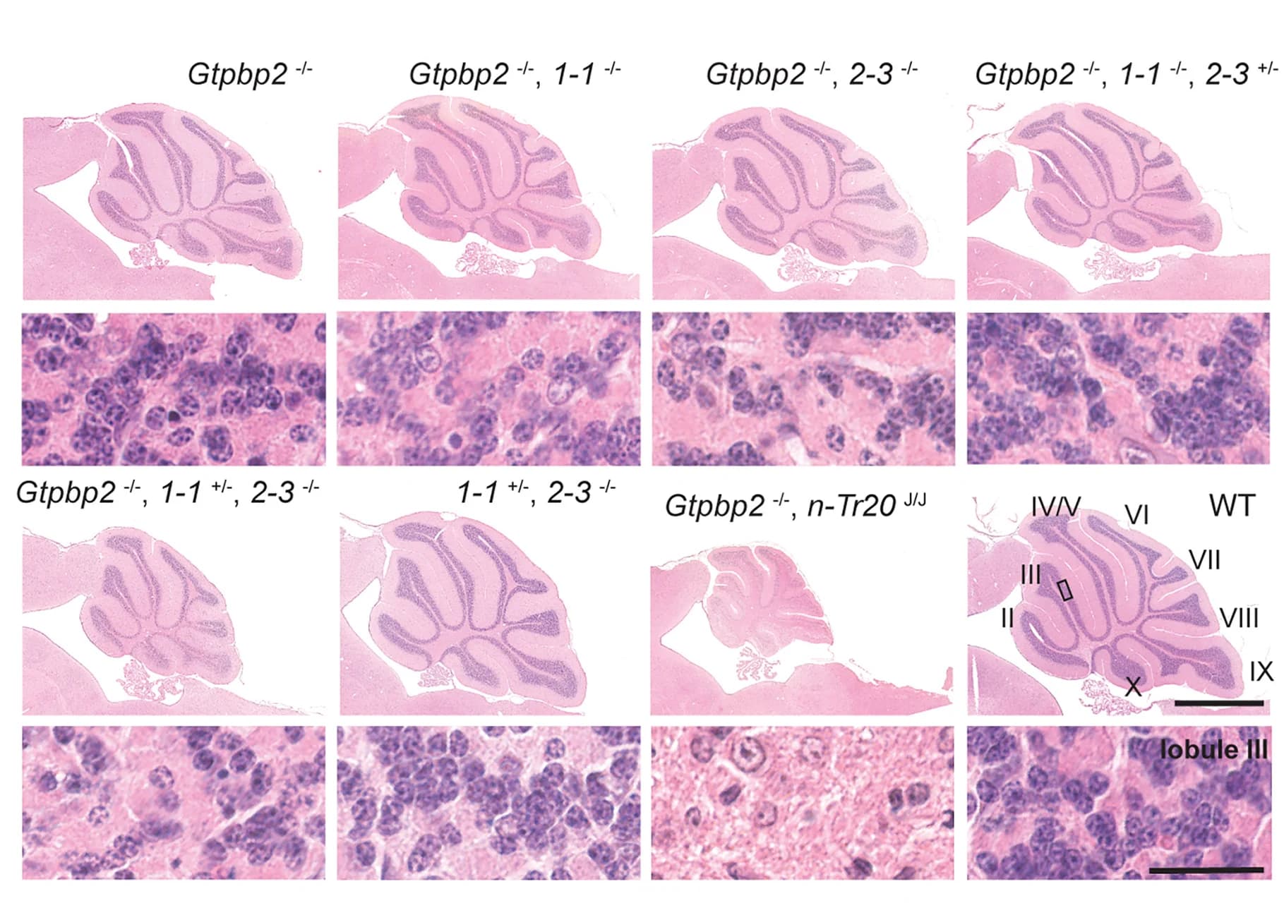 Open access visualization of Microscopy, tRNAIle(TAT) Pool, Gtpbp2 Loss, Cerebellar Granule Cell, Degeneration