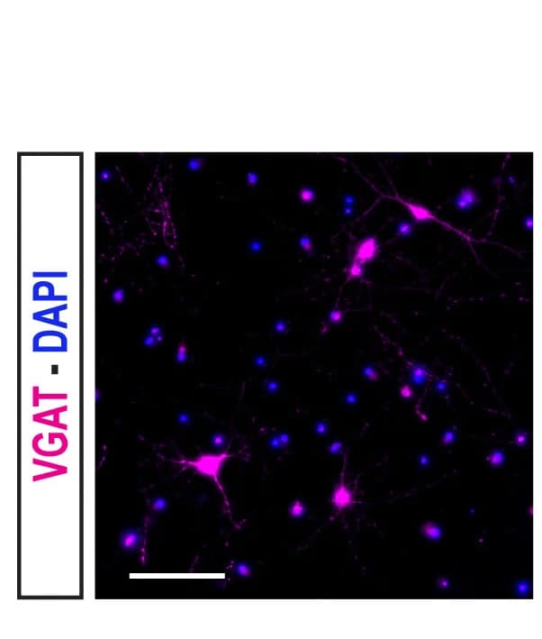 Open access visualization of Microscopy, GABAergic Interneurons, VGAT, Scale Bars