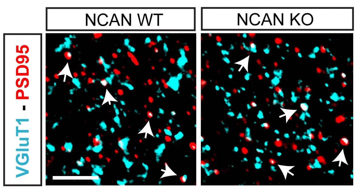 Open access visualization of Microscopy, Electron Microscopy, Excitatory Synapses, ACC, L5