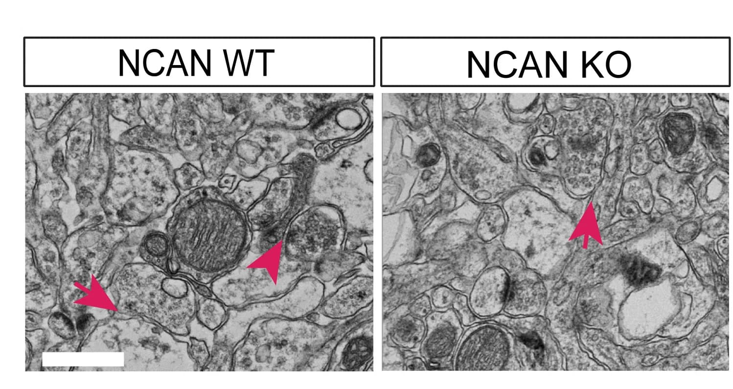 Open access visualization of Microscopy, Electron Microscopy, NCAN, WT Mice, KO Mice