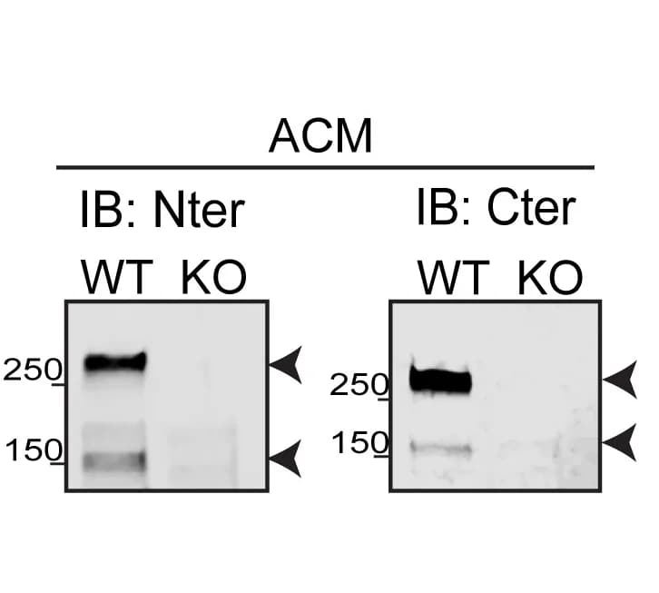 Open access visualization of Gel, Western Blot, NCAN N-terminal, NCAN C-terminal, NCAN WT ACM