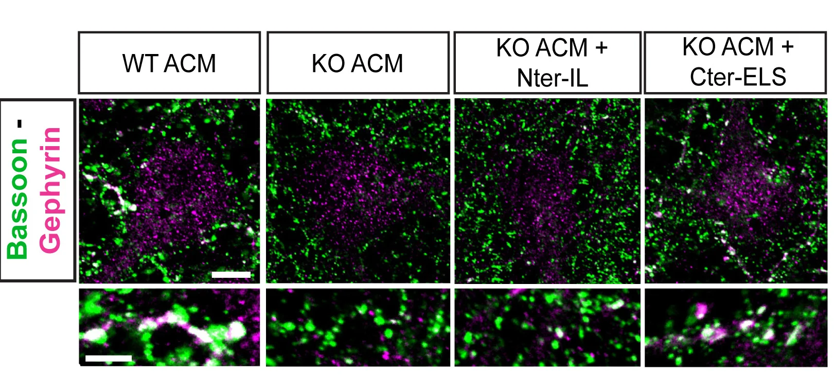 Open access visualization of Microscopy, Rescue Experiment, NCAN WT ACM, KO ACM, Recombinant Proteins