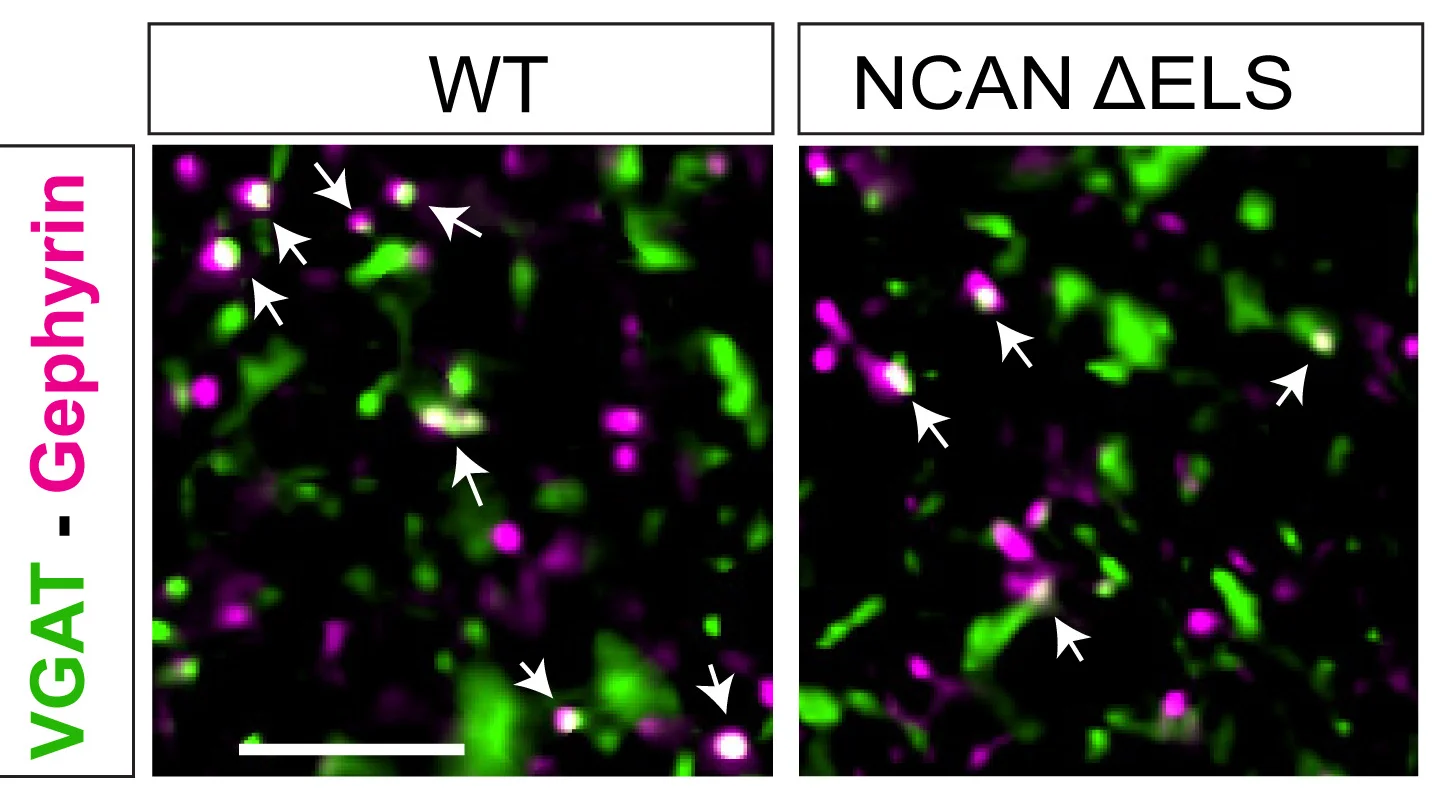 Open access visualization of Microscopy, Inhibitory Synapses, Anterior Cingulate Cortex, Mouse Brain, Wild Type Mice