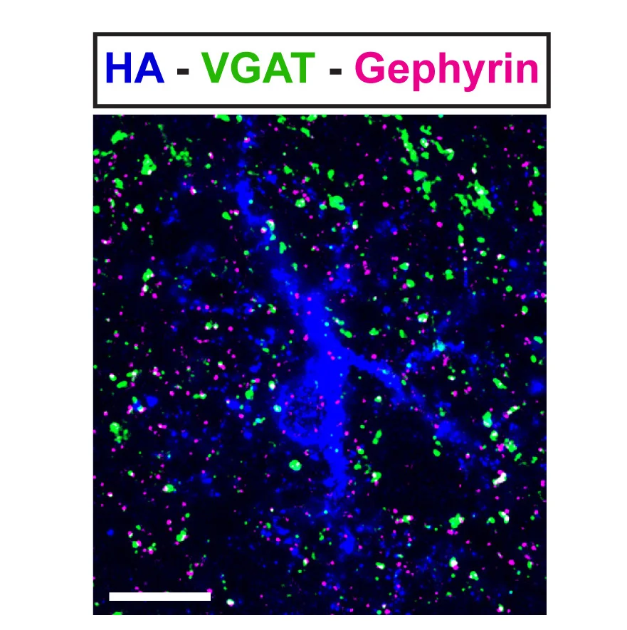 Open access visualization of Microscopy, Inhibitory Synapses, Astrocyte, Scale Bar