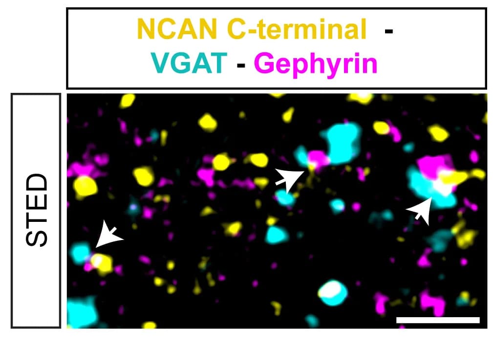 Open access visualization of Microscopy, STED Image, NCAN C-terminal, VGAT, Gephyrin