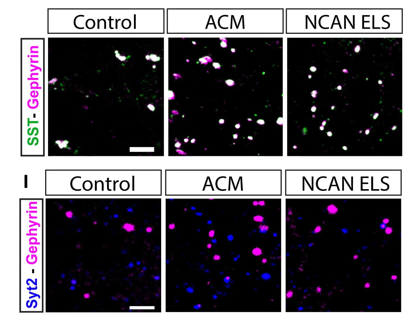 Open access visualization of Microscopy, SST+ Synapses, Neuronal Cultures, Control, ACM