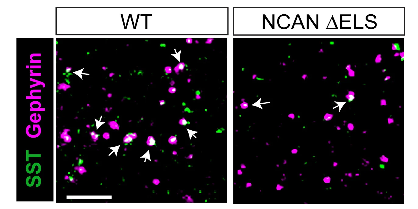Open access visualization of Microscopy, SST+ Synapses, ACC L1, NCAN WT Mice, ΔELS Mice