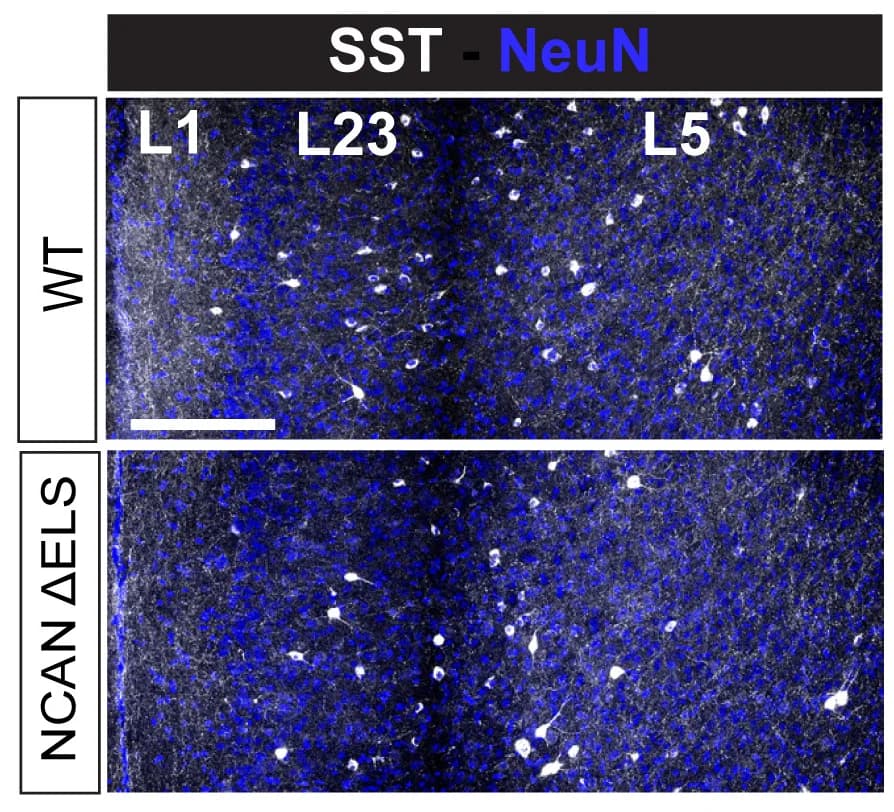 Open access visualization of Microscopy, SST+ Neurons, ACC, NCAN WT Mice, ΔELS Mice