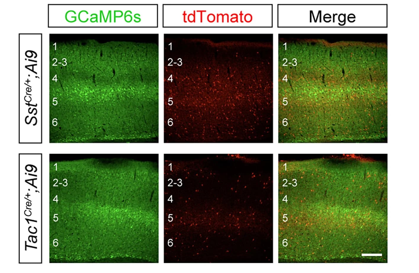 Open access visualization of Microscopy, Coronal Sections, GCaMP6s, tdTomato, S1BF