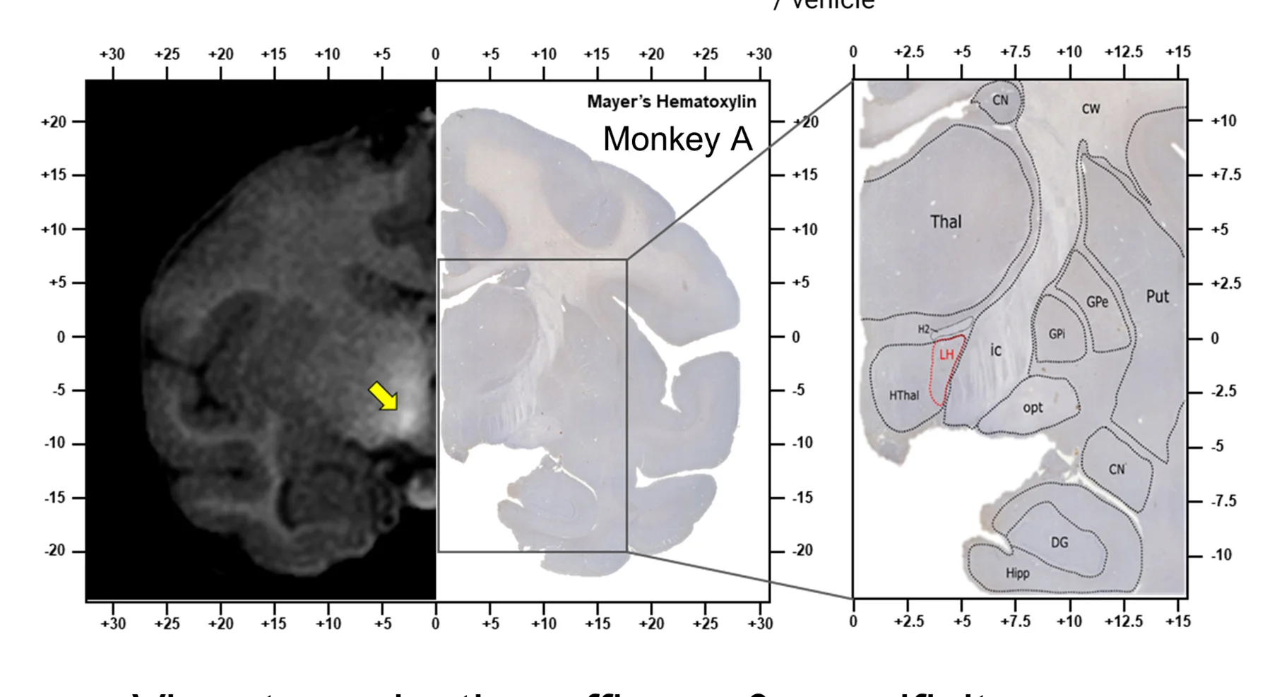Open access visualization of Microscopy, Viral Injection, MRI, Histological Analysis, AAV