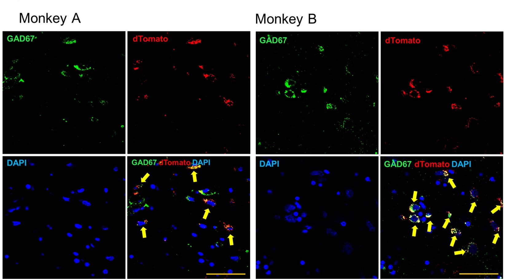 Open access visualization of Microscopy, Immunofluorescence Analysis, Glutamate Decarboxylase 67, GAD67, dTomato Expression