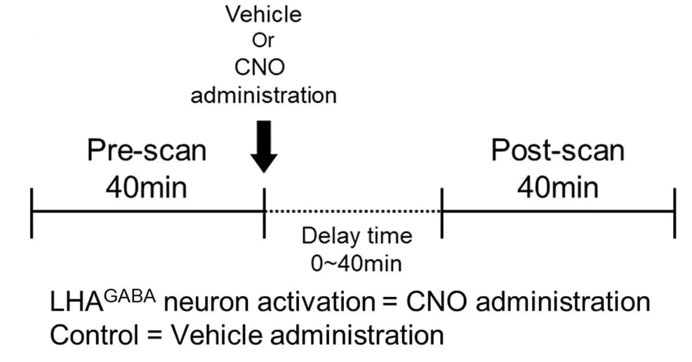 Open access visualization of Workflow, Illustration, Cerebral Blood Volume, rs-fMRI, MION