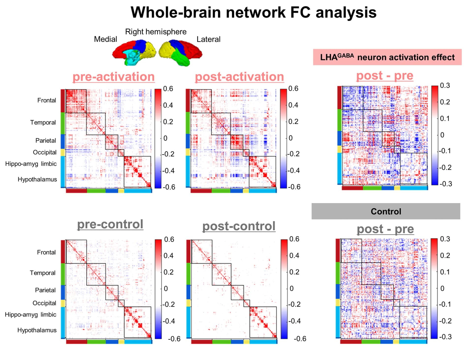 Open access visualization of Heatmap, Whole-Brain Network FC Analysis, FC Matrices, Regions of Interest, Pre-Activation
