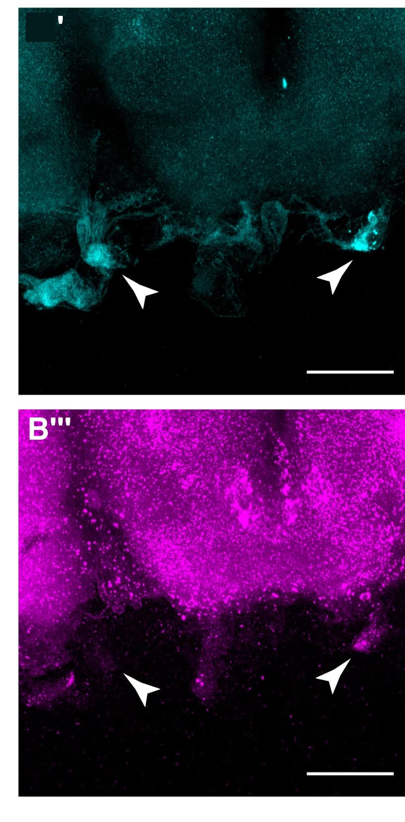 Open access visualization of Microscopy, AKHR Neurons, GFP, VAchT, Immunostaining