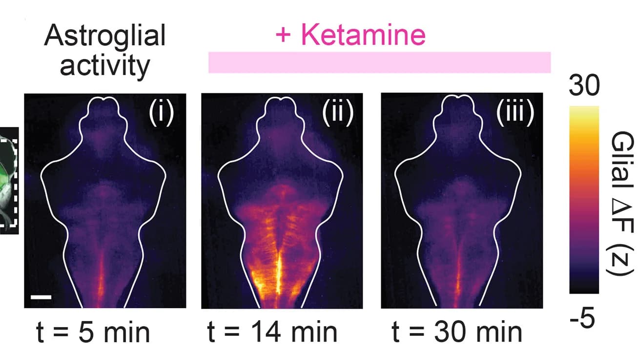 Open access visualization of Microscopy, Fluorescence Micrographs, Calcium, Ketamine, jRGECO1a Signal