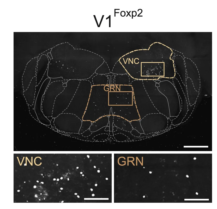 Open access visualization of Microscopy, STPT Projection, Caudal Brainstem, RV-infected Neurons, GRN Neurons