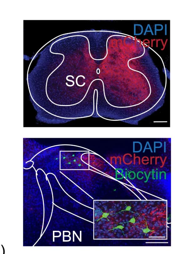 Open access visualization of Microscopy, Virus Expression, Neurons, DAPI, Biocytin