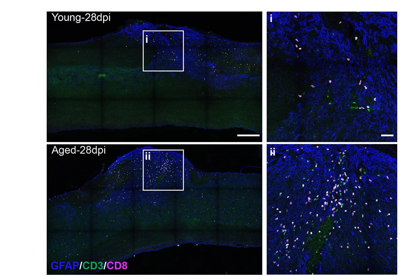 Open access visualization of Microscopy, Immunostaining, Spinal Cord, Sagittal Sections, CD8+ T Cells